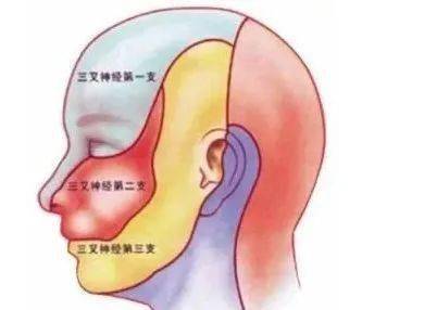 快速解决头晕头痛的办法 92a94f83d830442cb27bbcea329dc658.jpeg