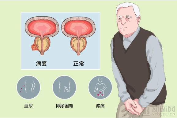 全球一共多少人口2017_西贝尔全球一共多少辆(3)