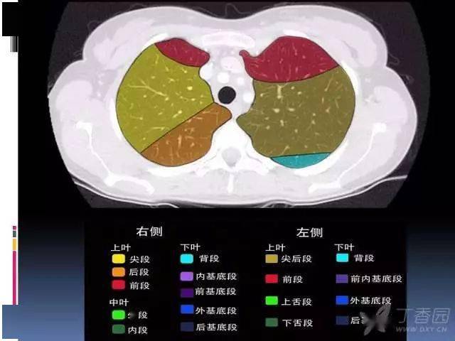 肺叶分段,支气管,肺动脉 ct 图谱全在这-值得收藏