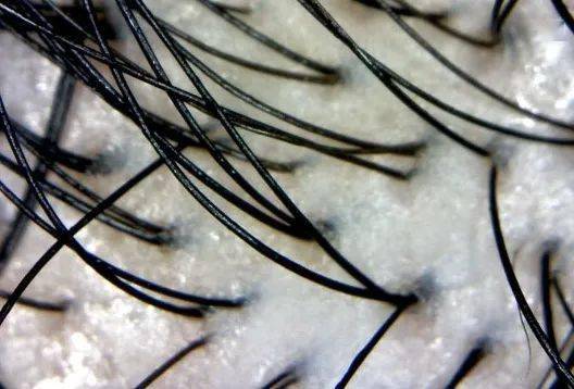 宝藏|头发一把把掉？这个土耳其宝藏固发神器，竟然一步搞定防脱、控油、去屑！