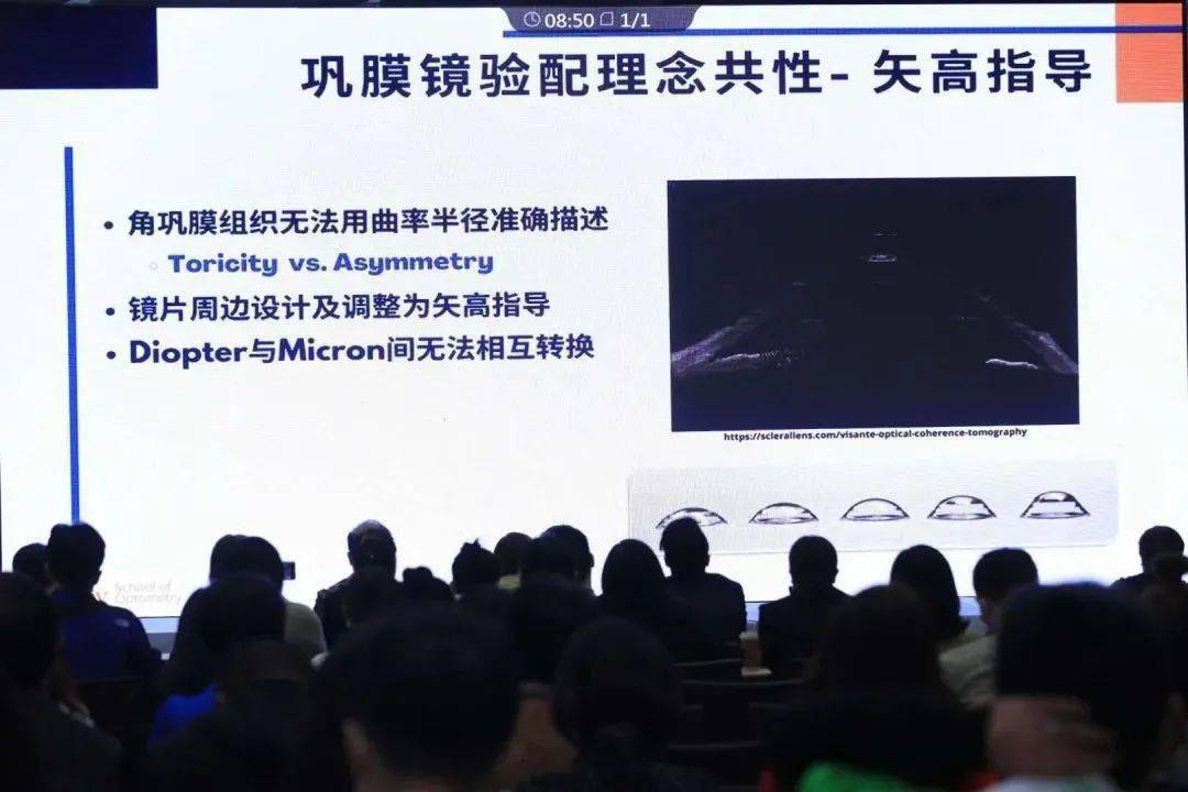 多焦软镜多焦rgp巩膜镜vc2020特殊接触镜专场全记录