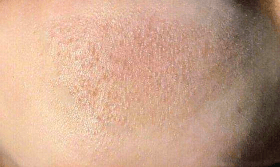 金鹰节|这位小鲜肉要演《以痘痘之名》?