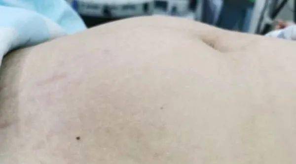 男生肚子怎么变大了 994d5df0ae24405e8f19b45875df8761.jpeg