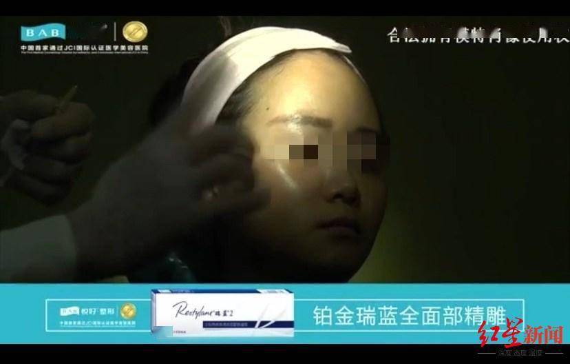 恒达官网整形悲剧:“成都赵丽颖”没当成,鼻子还变形 院方:手术确实出了问题 (图9) 恒达官网整形悲剧:“成都赵丽颖”没当成,鼻子还变形 院方:手术确实出了问题 (图9)