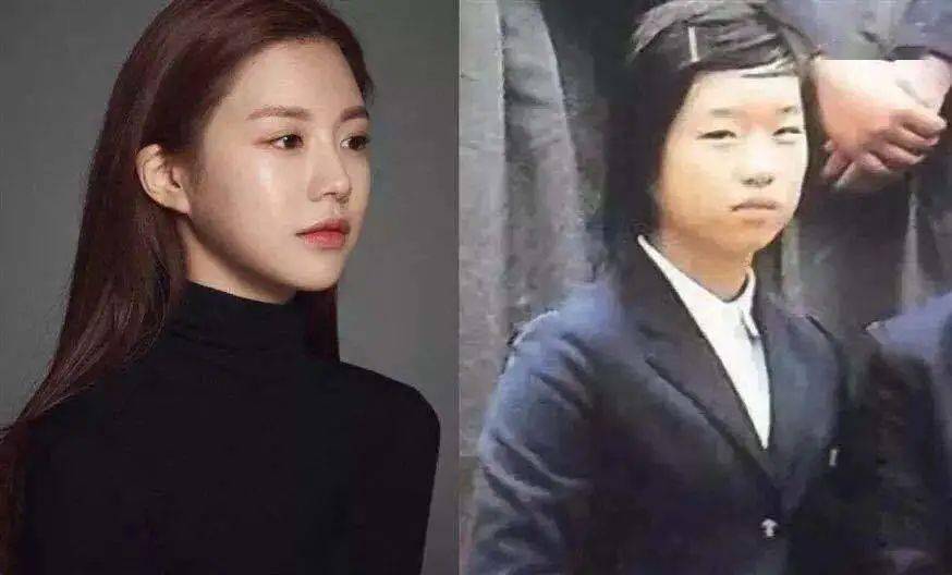 双杠|“悲伤蛙”，双杠眼……双眼皮到底怎么割？！