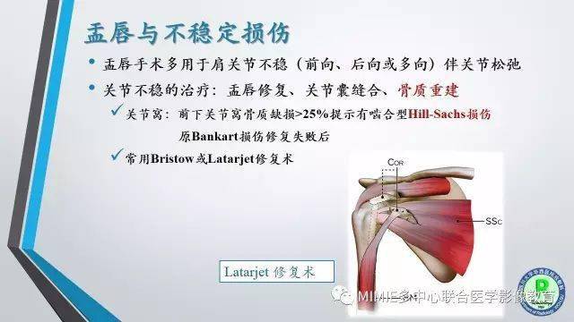 术后肩关节影像:肩袖,盂唇及二头肌腱