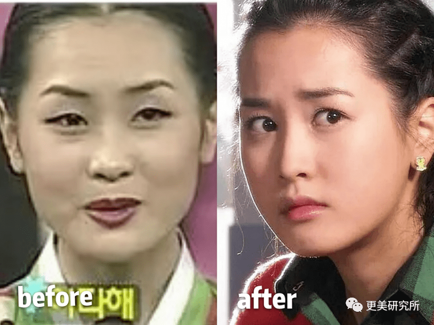 卡卡|横跨三代、100个女星同时削掉半张脸,没想到垫底的却是她...