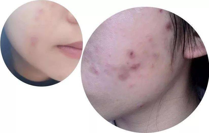 柳燕|周迅素颜吓坏路人，张曼玉真容让粉丝失望！女明星容颜破灭，都因为没做好这件事！