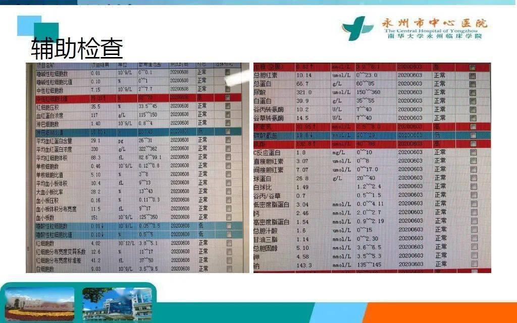 患者|病例分享 | 术中凝血功能障碍一例