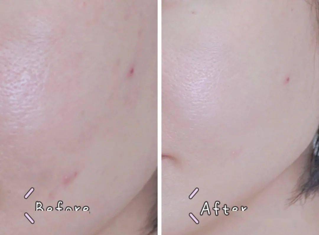 少年|刘昊然开挂 竟让我知道了少年感的打开方式