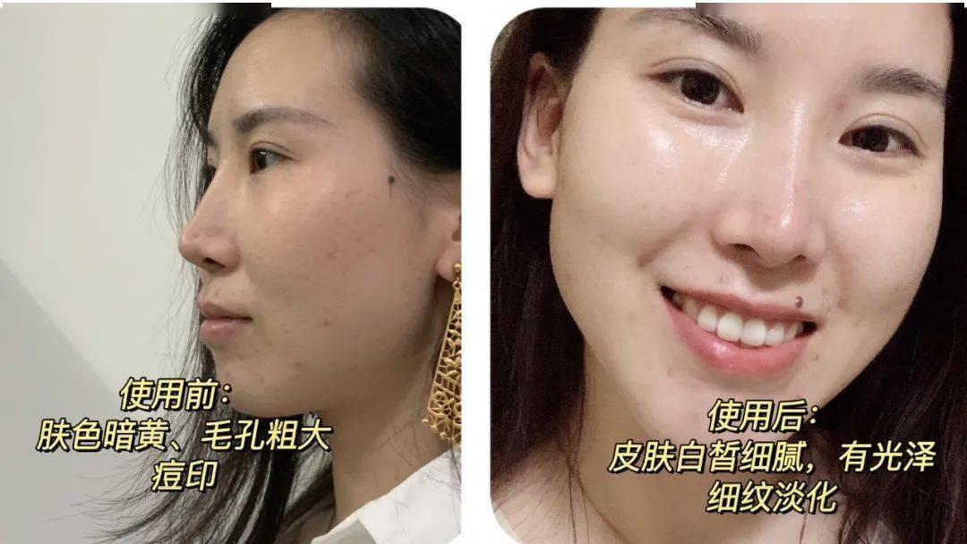 肌肤|凭什么别人都美得那么高级？