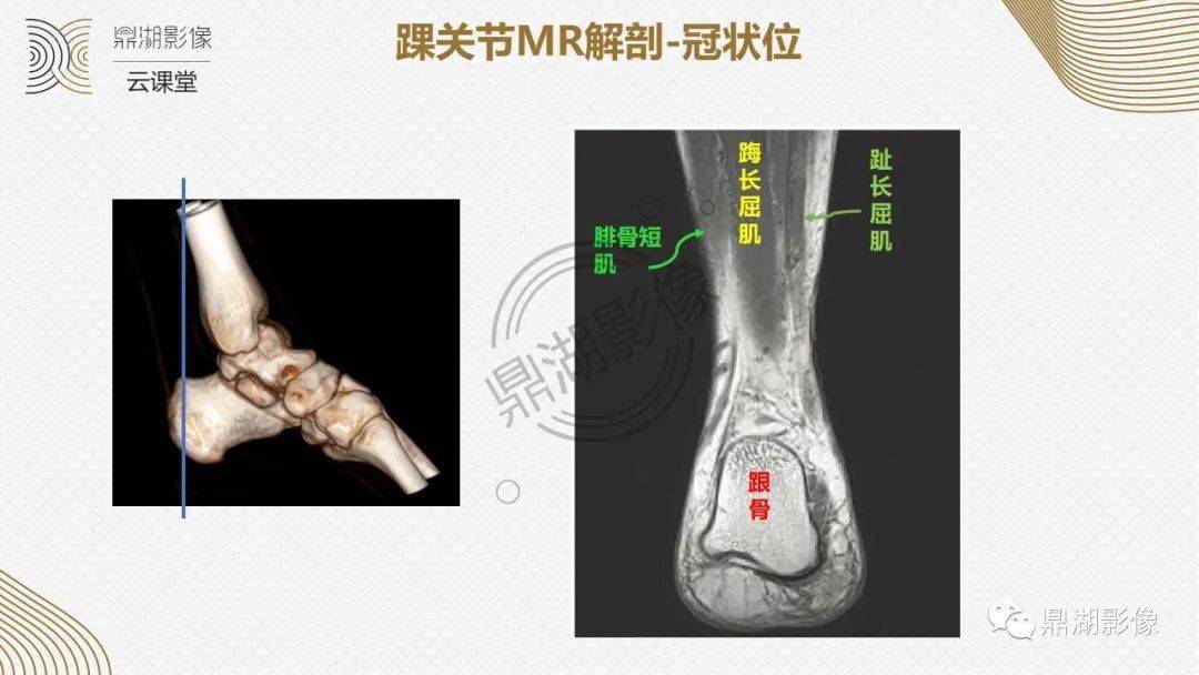 超赞,这个踝关节mri解剖课件要给满分!