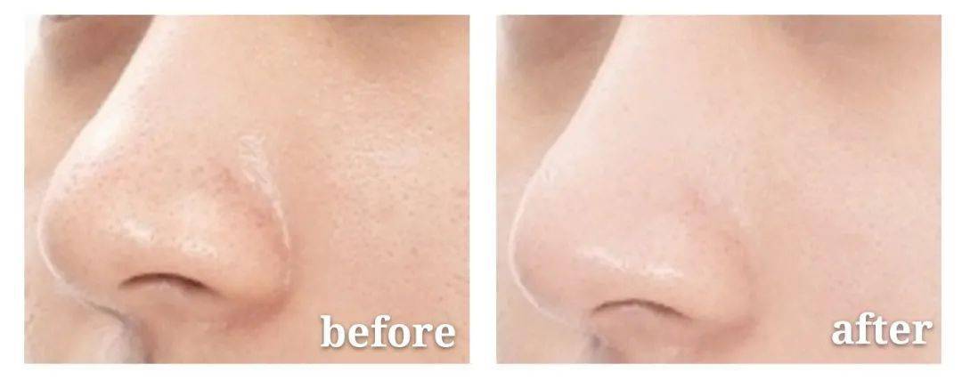 皮肤|狂吃火锅不长痘，这位影后太拉仇恨！