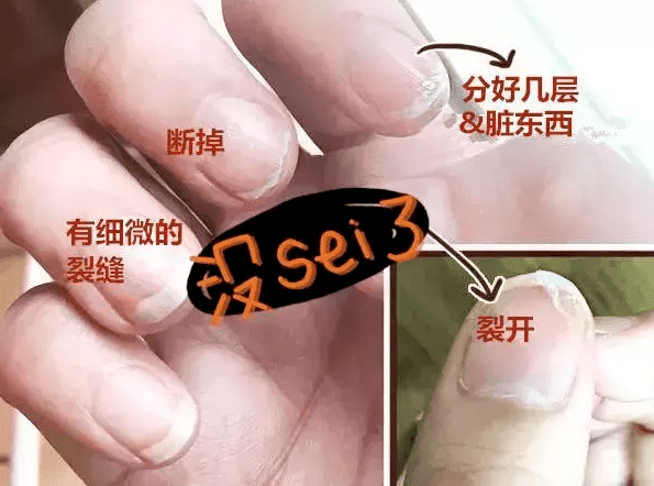 ta|十斤黑芝麻都比上2颗ta！风靡美国的这颗糖把头发越吃越密，皮肤也变好了，感觉年轻10多岁！