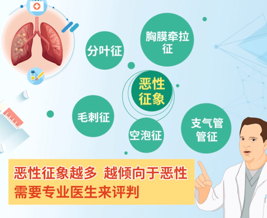 检查|106人肺结节，3人肺癌！肺结节被确诊为肺癌的几率到底有多高？