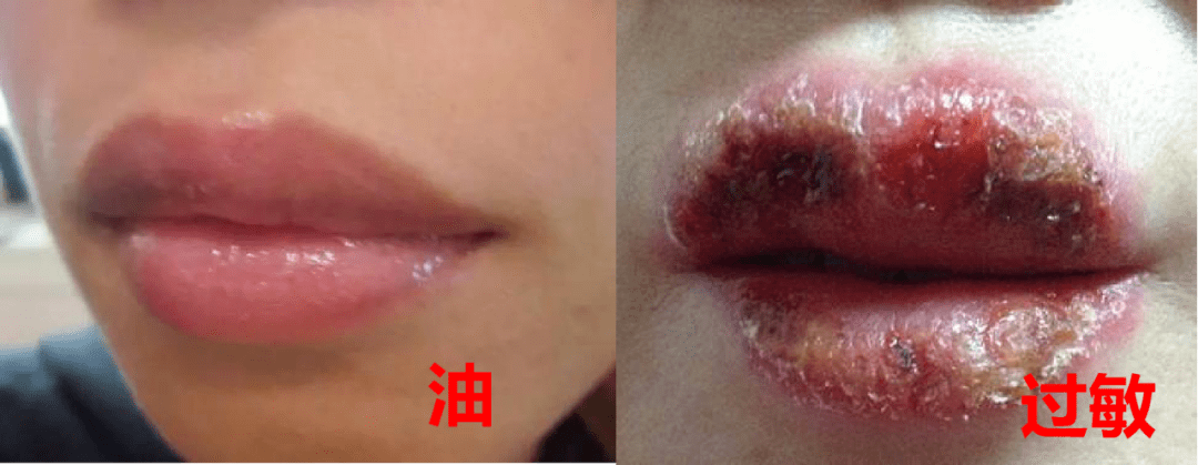 唇膏|干唇星人唇膏，轻松摆脱干燥开裂的“沙漠唇”！