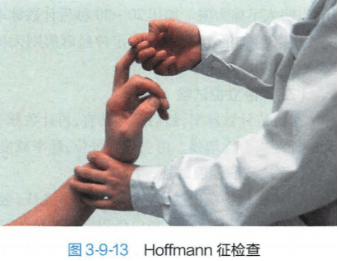 hoffmann 征(一)_霍夫曼