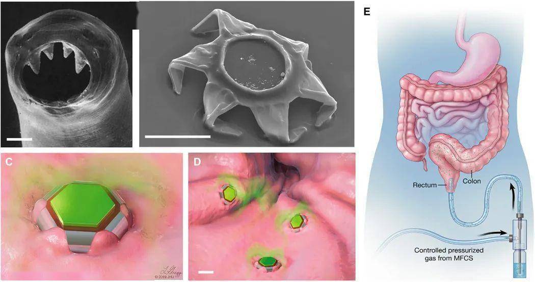 设备|【Science子刊】约翰·霍普金斯大学创造灰尘大小设备，可协助药物在胃肠道停留24小时之久!