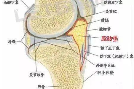 如下图所示,脂肪垫位于髌骨下1/2段边缘,在股骨,髌骨,胫骨之间成三角