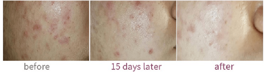 少女|35岁辣妈，生完2个孩子还是一张少女脸，她一语道破衰老真相......