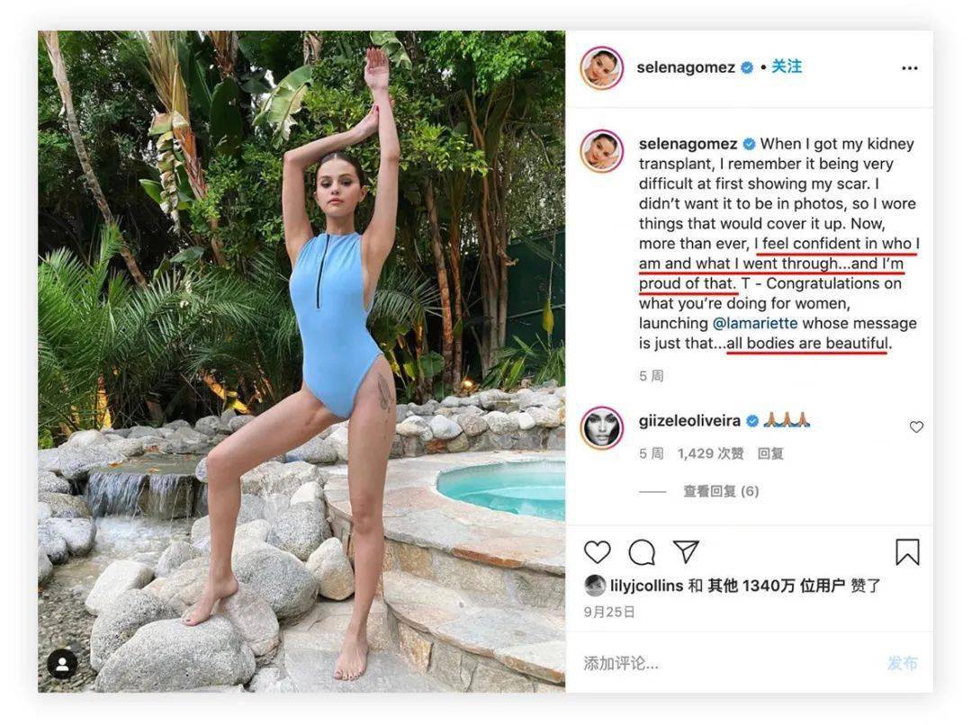 Rare|患病抑郁的赛琳娜，终于又美回来了！