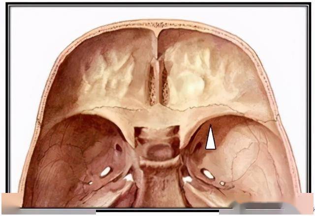 前中颅窝的上下面观
