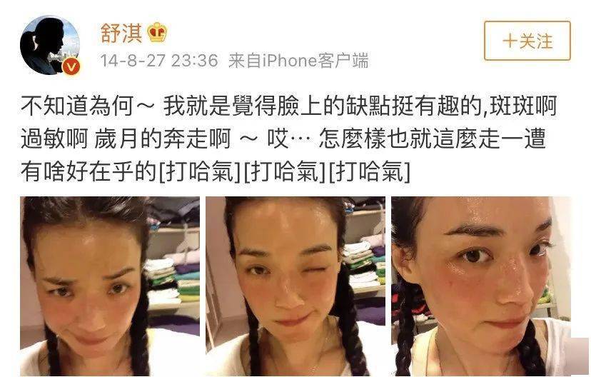 皮肤|终于找到女神舒淇同款过敏的应对方法了