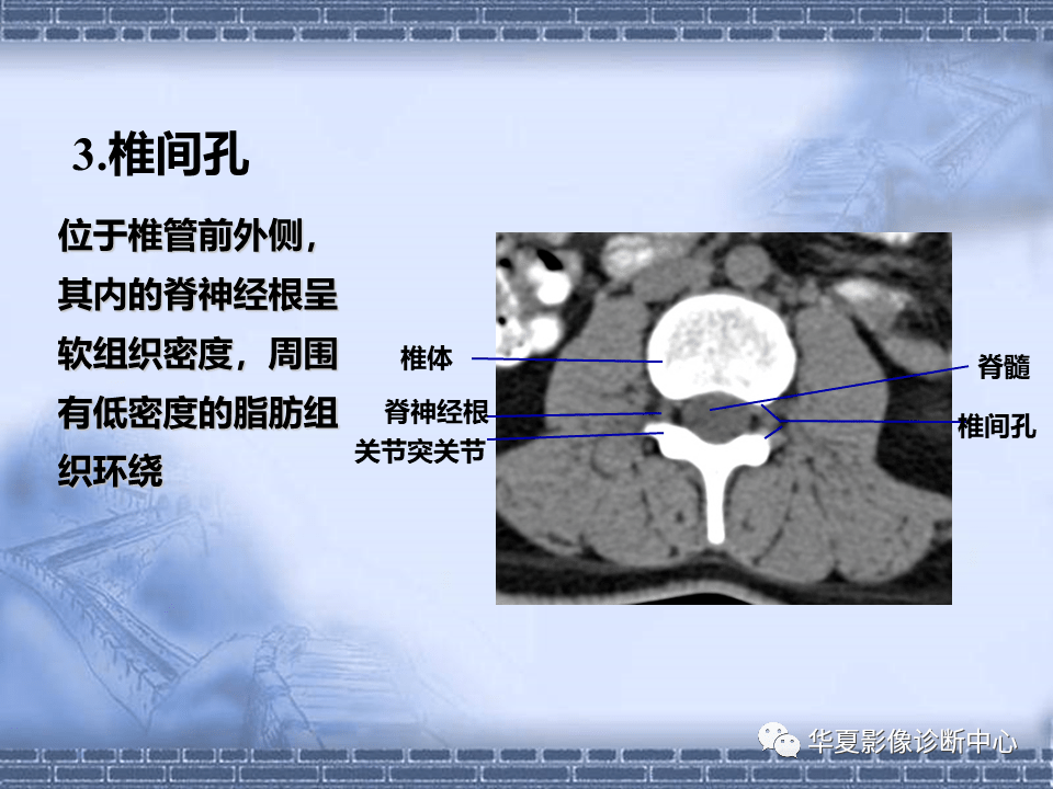 颈椎,腰椎ct常见病变