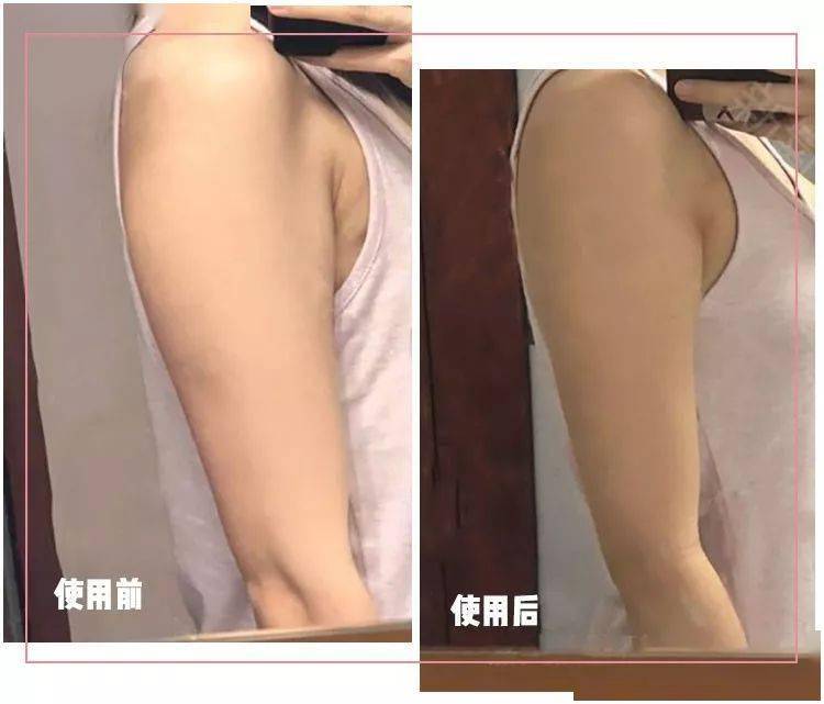 手臂|身体这个部位，男生怕它细，女生怕它粗.....