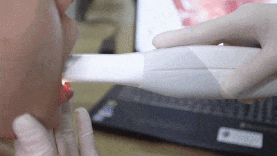 牙齿|出道前do了这里，现在的她也太惊艳了吧！