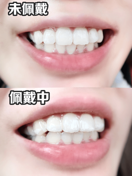 牙齿|出道前do了这里，现在的她也太惊艳了吧！