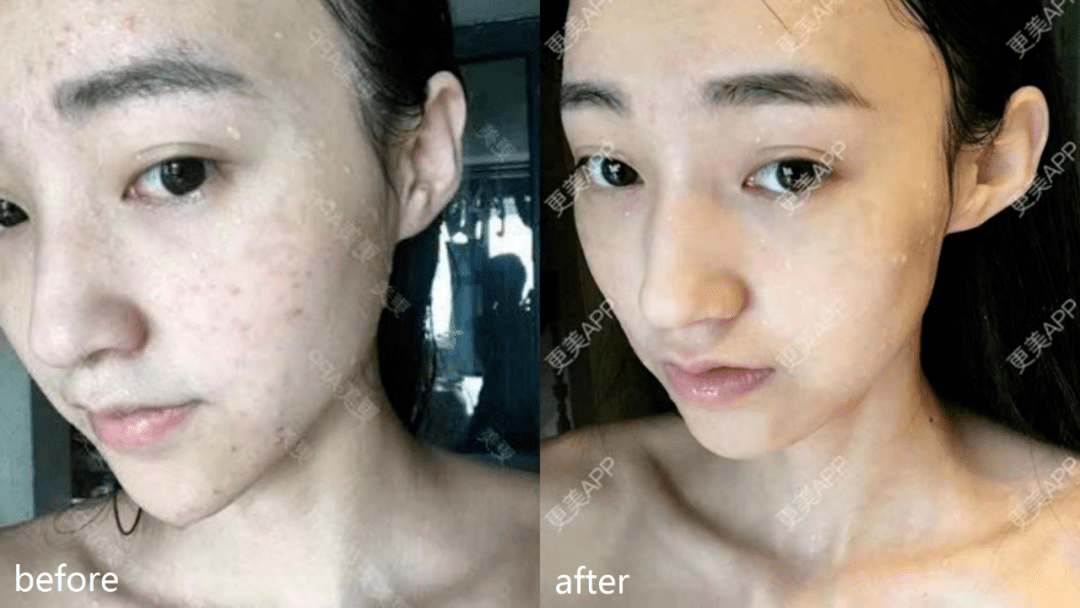 皮肤|杨幂早期合照见心机？看完原图呆了，她们这么早竟都整了...