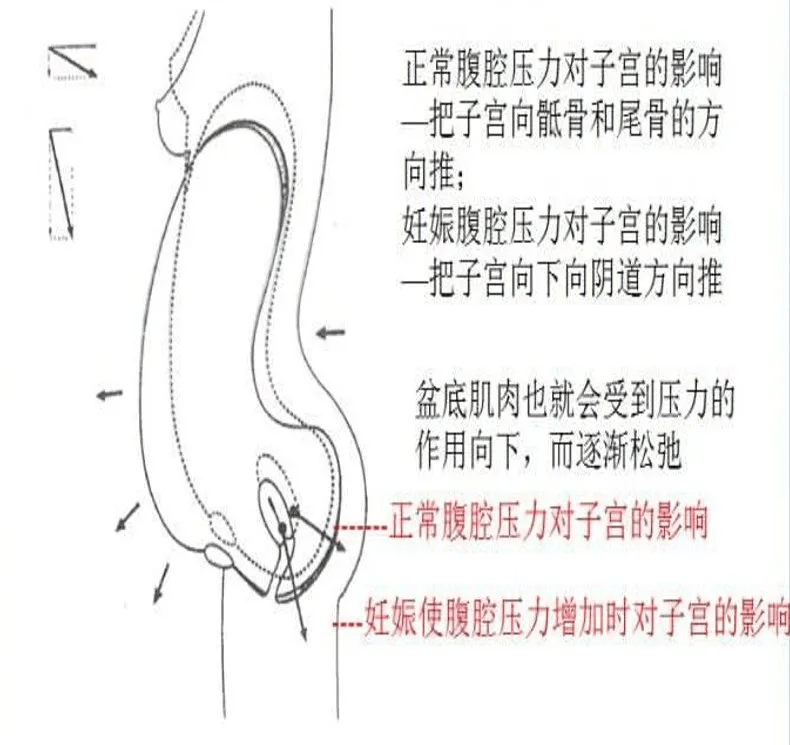 难言之隐|漏尿、阴道松弛、子宫脱垂……这些＂难言之隐＂可以治好吗？