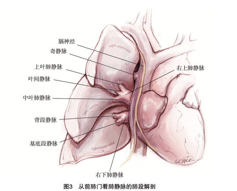 胸腔镜肺叶切除及肺段切除手术图谱｜胸部疾病肺段切除_手机搜狐网