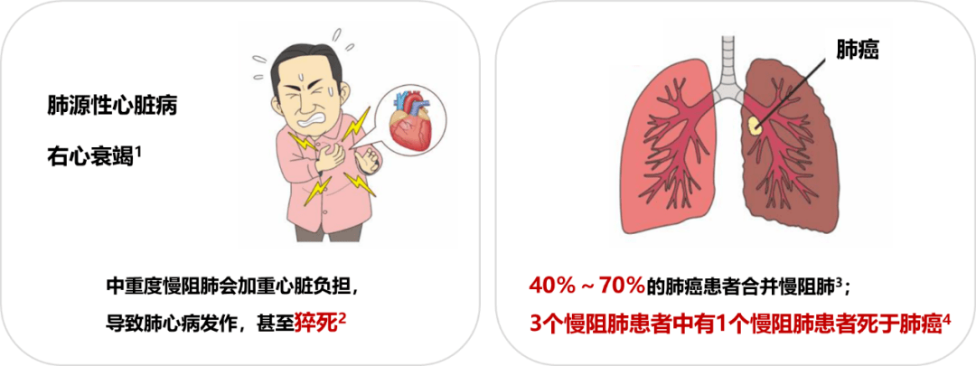 吸烟太多会患这病?11月18日"世界慢阻肺日"邀您参加!