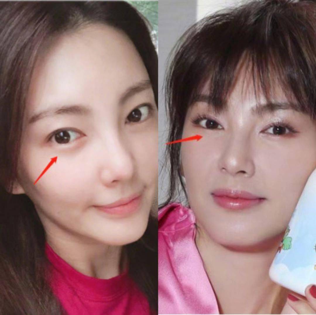 开眼角的视频 5ccb7247ebb44707840aa922a99fbcc1.jpeg