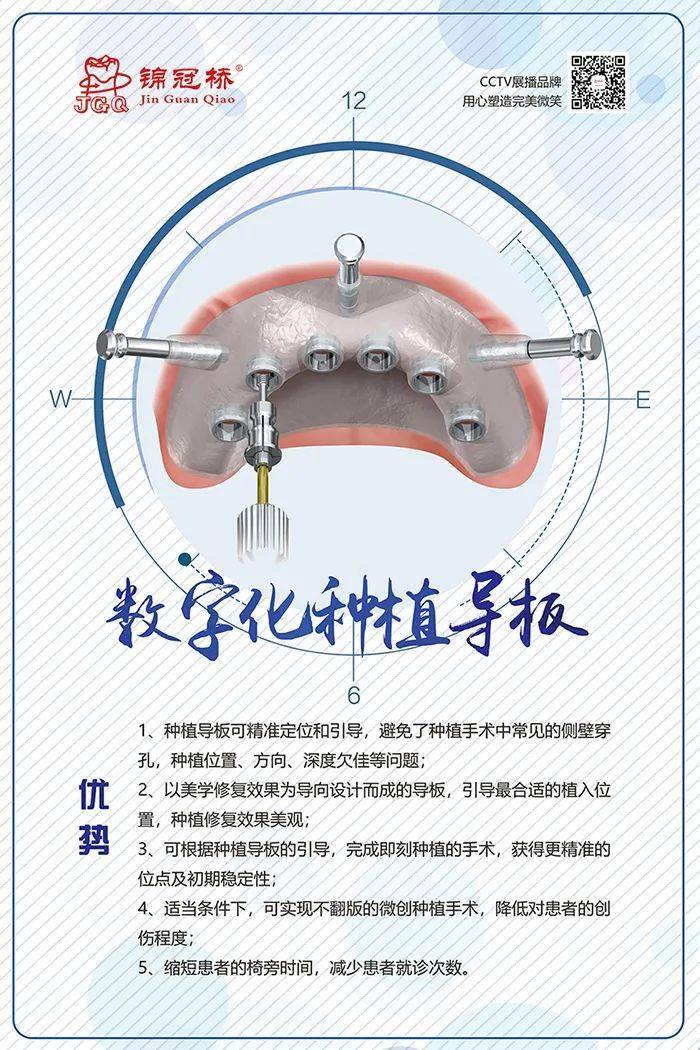 你了解数字化种植导板吗?