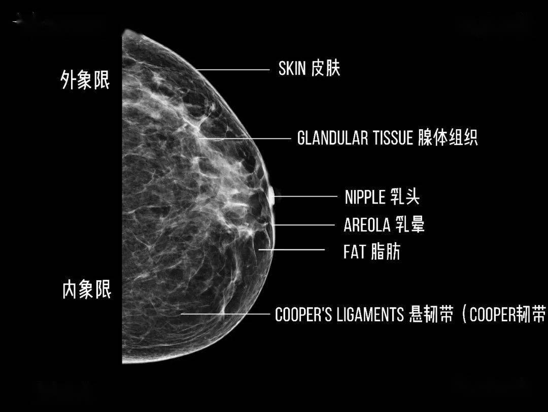 【附图】乳腺导管原位癌钼靶摄片及MRI表现_乳腺肿瘤学 | 天山医学院