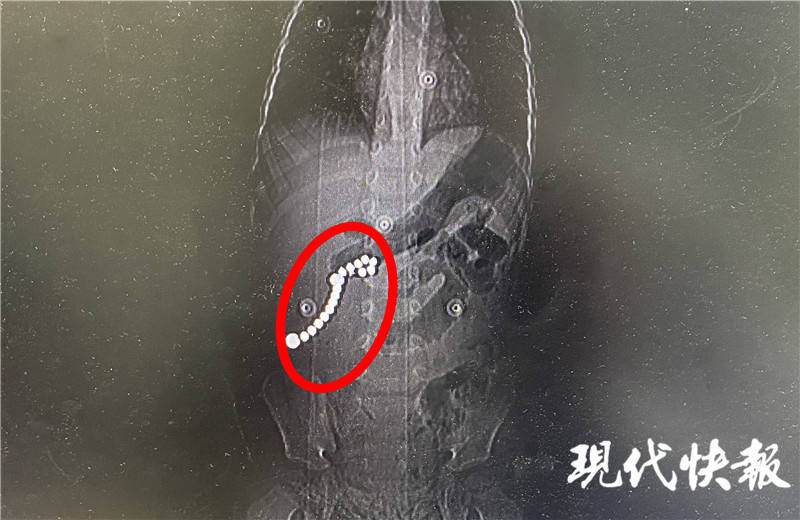 孩子|胃肠8处穿孔惊险！2岁女童误吞15粒磁力珠