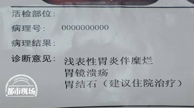 胃石会逐渐变大,给胃部造成很大伤害,更严重的话就会导致胃出血