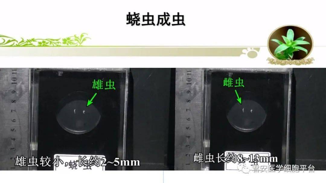 蛲虫及其虫卵之美图