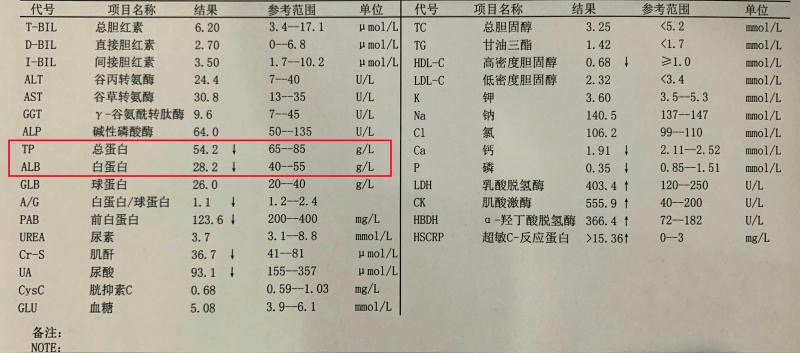 大腿水肿怎么办