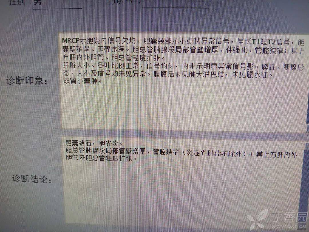mrcp 检查报告肝功能结果保肝 1 周后复查肝功能结果进一步行 ct 检查