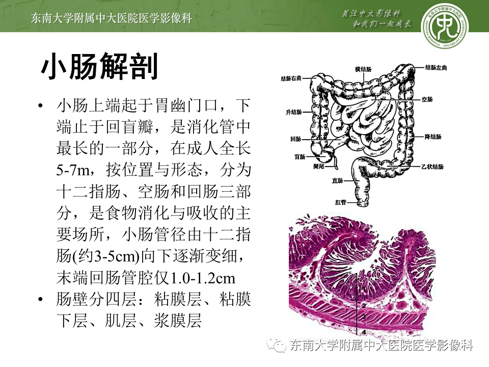 消化系统小肠淀粉样变性