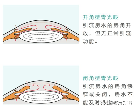 7a737f58ab2d4b5ab4adacdeb29a2c44.png