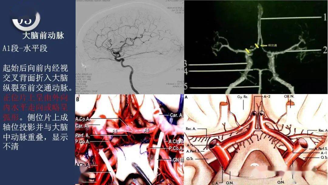 高清头颈动脉系统解剖