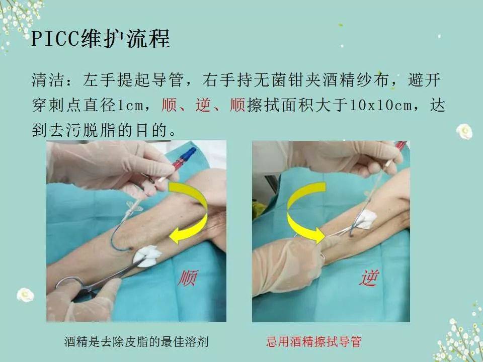 pptpicc导管的维护