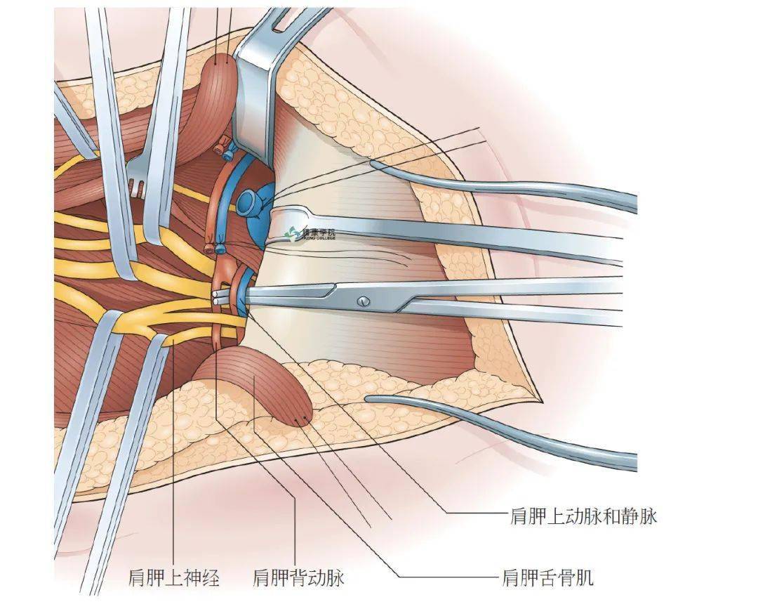 臂丛应用解剖