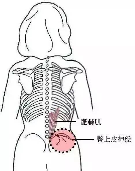 二十七,髂后上嵴内侧缘压痛点髂后上嵴内侧为骶棘肌外缘附着点,压痛常