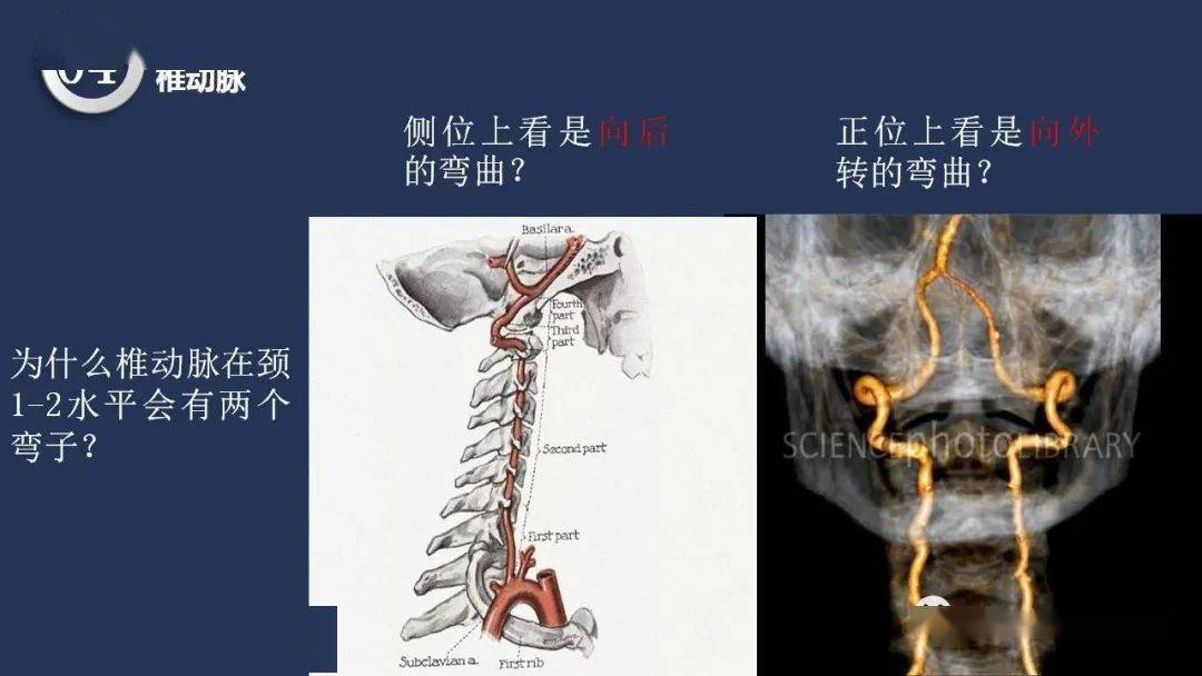 精彩推荐 高清头颈动脉系统解剖